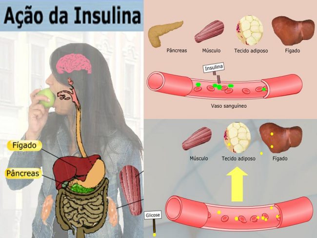 Biologia No Enem Resumo Geral Sobre Diabetes